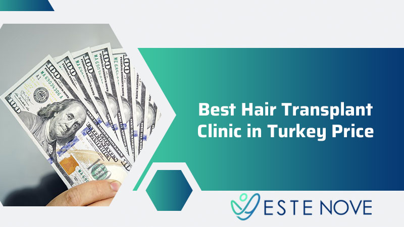 Best Hair Transplant Clinic In Turkey Price Estenove