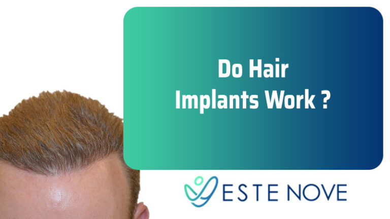 hair implant cost