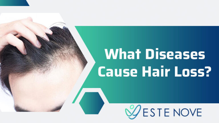 what-diseases-cause-hair-loss-estenove