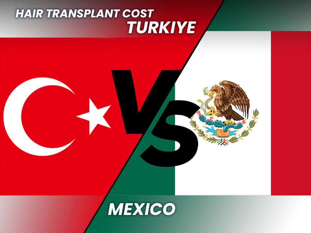 Hair transplant mexico vs turkey