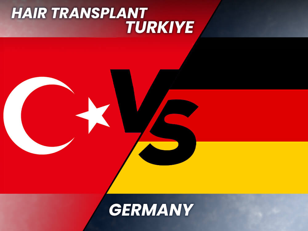 Germany vs Turkey for Hair Transplants