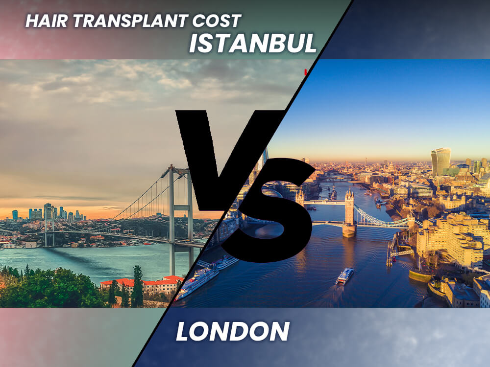 Hair Transplant Cost London vs Istanbul