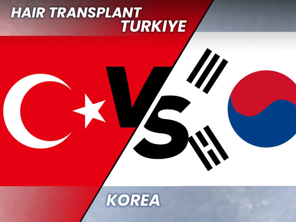 hair-transplanat-korea-vs-turkey