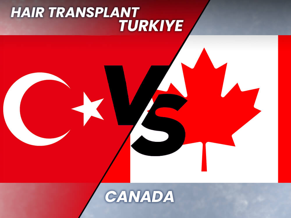 Hair Transplant Canada vs Turkey Cost & Procedure Comparison