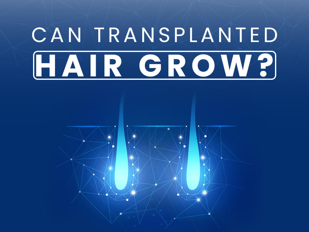 Can Transplanted Hair Grow