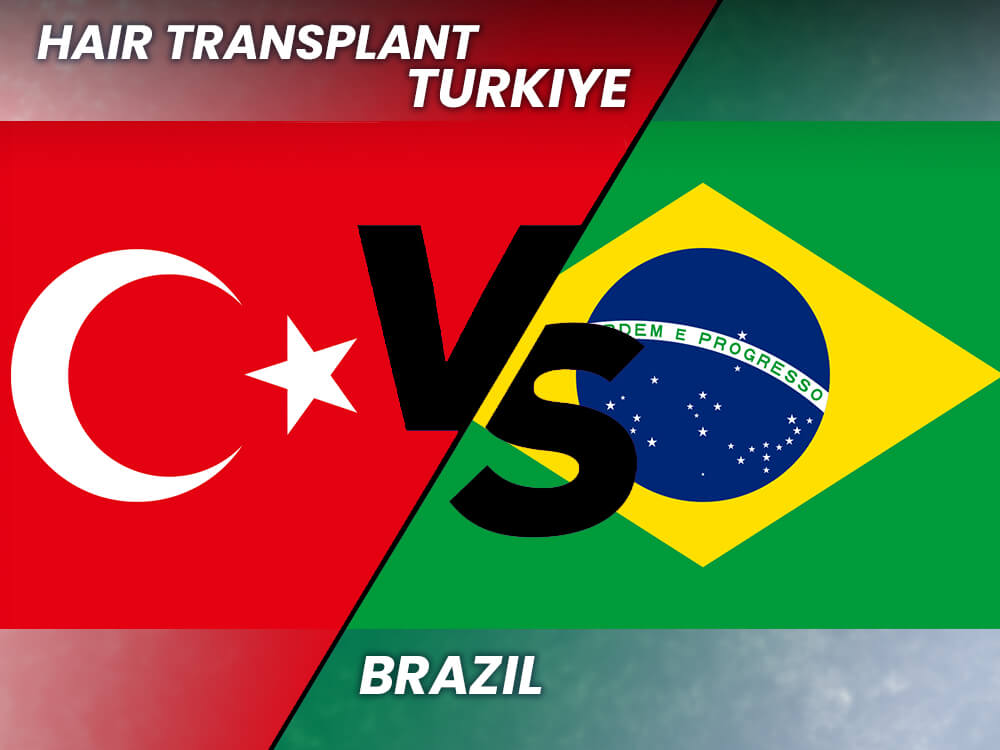 Hair Transplant Brazil vs Turkey