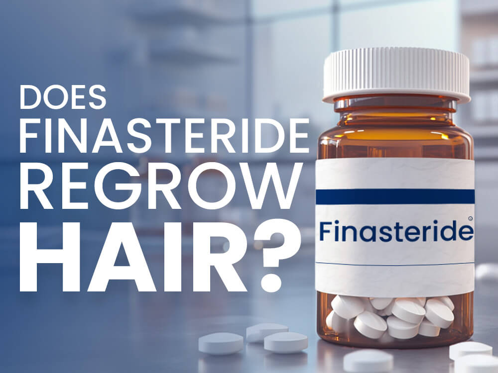 Does Finasteride Regrow Hair