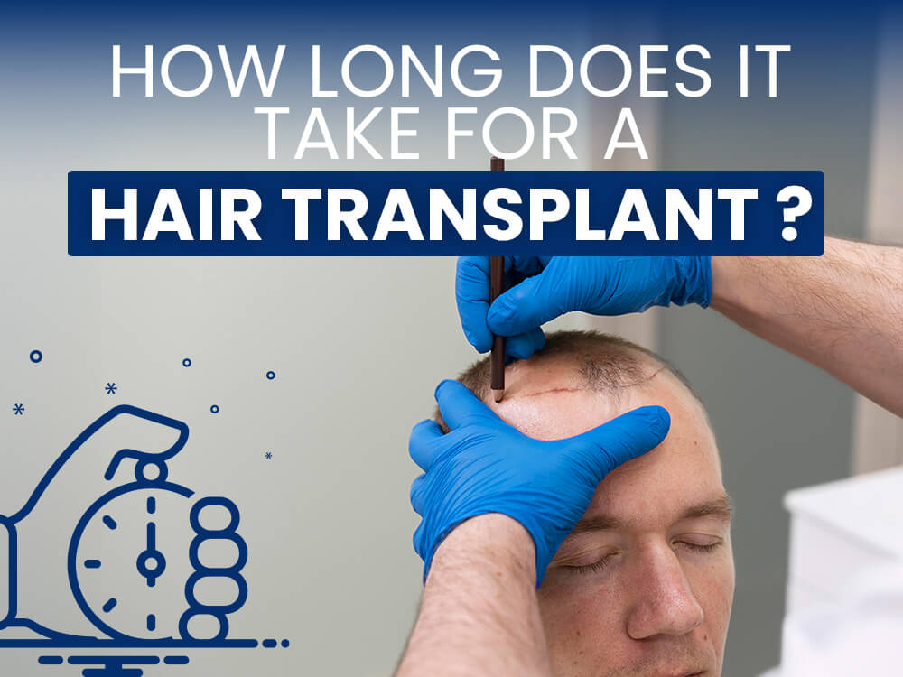 How long does it take for a hair transplant