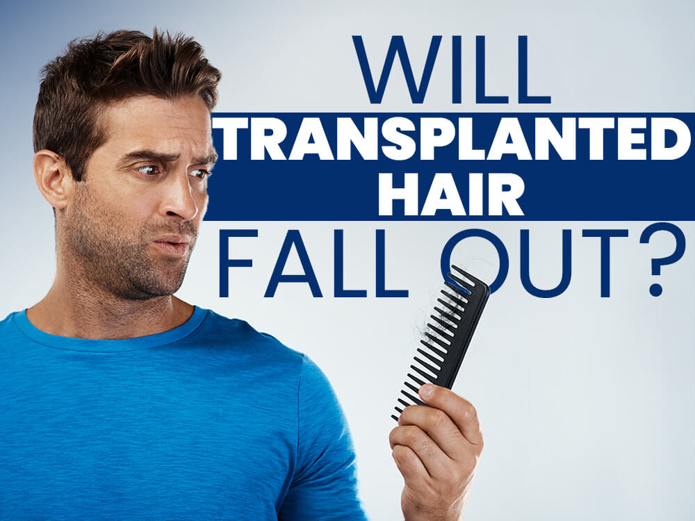 Will Transplanted Hair Fall Out